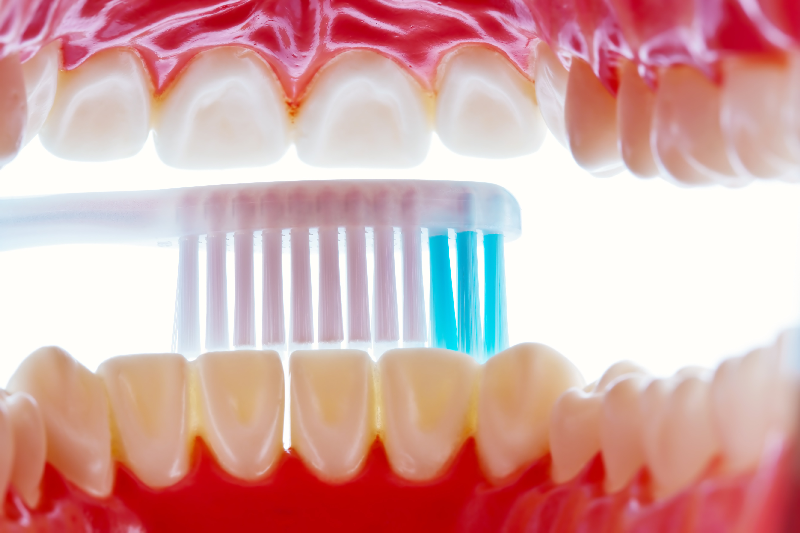 Gáspár Dental szájhigiéniai szolgáltatások szájápolás lézeres kezelés