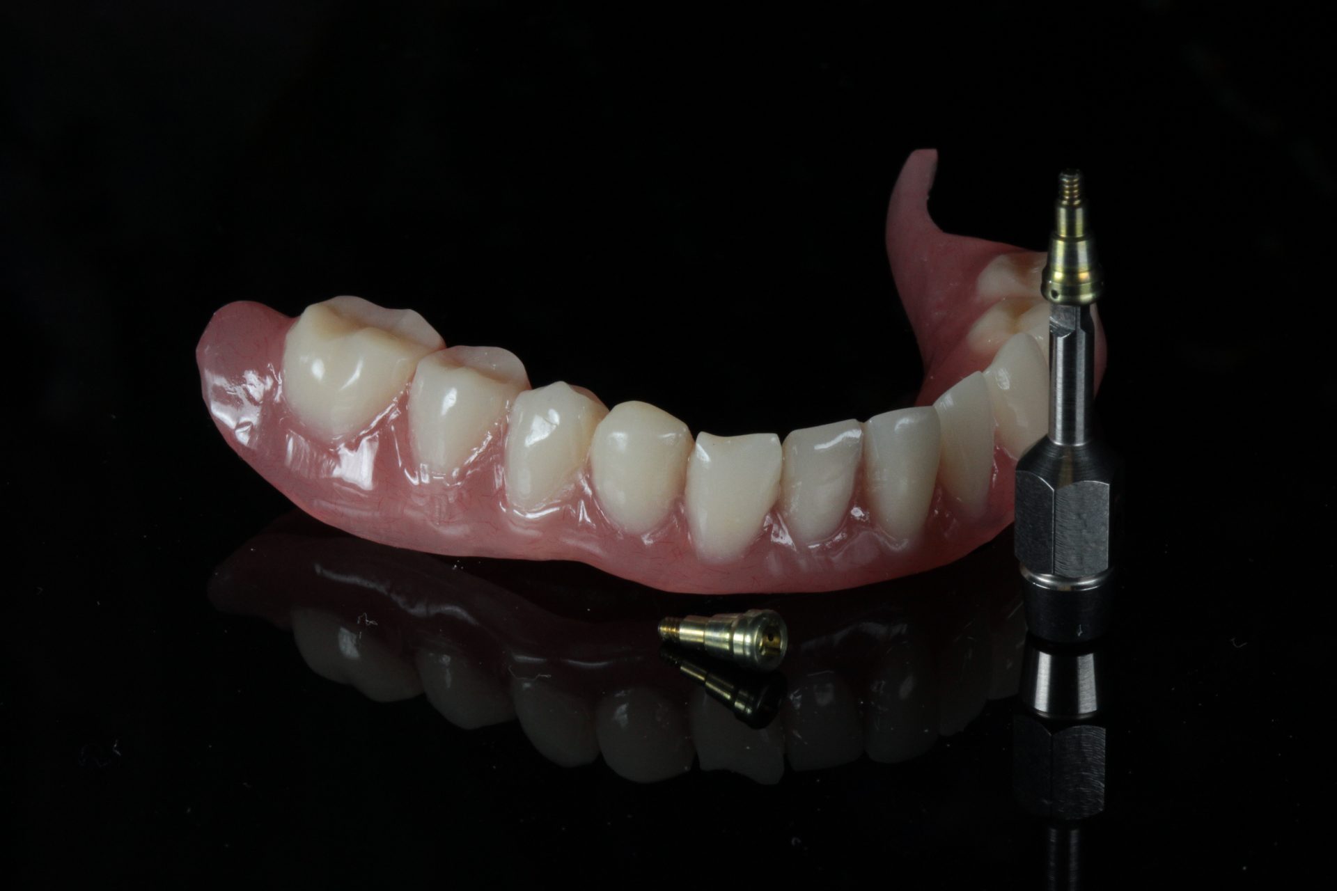 kivehető fogpótlás Gáspár Dental fogsor