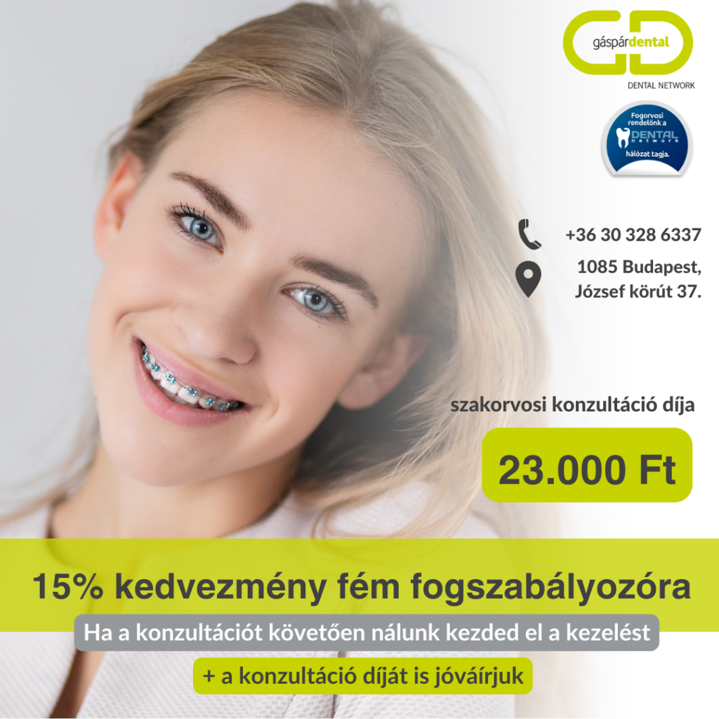 Fém fogszabályozó akció