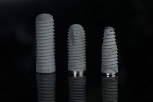 A fogászati implantológia fejlődési tendenciái – kezdetektől napjainkig dióhéjban