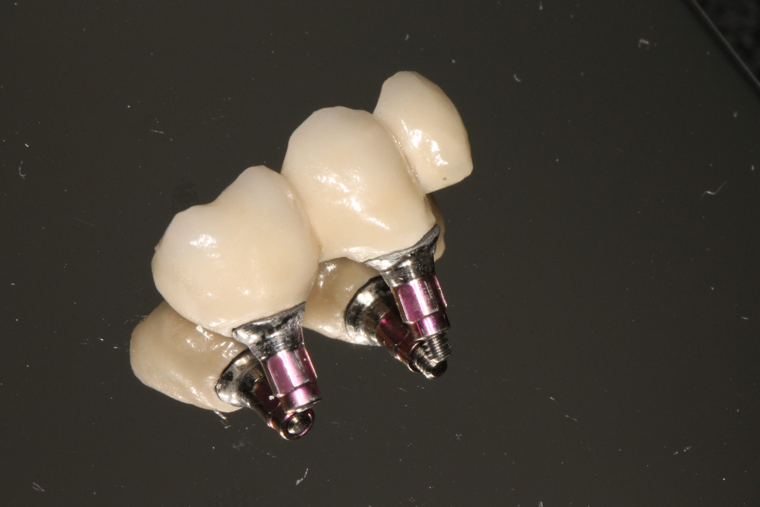 Az implantológia fejlődésének tudományos tendenciái