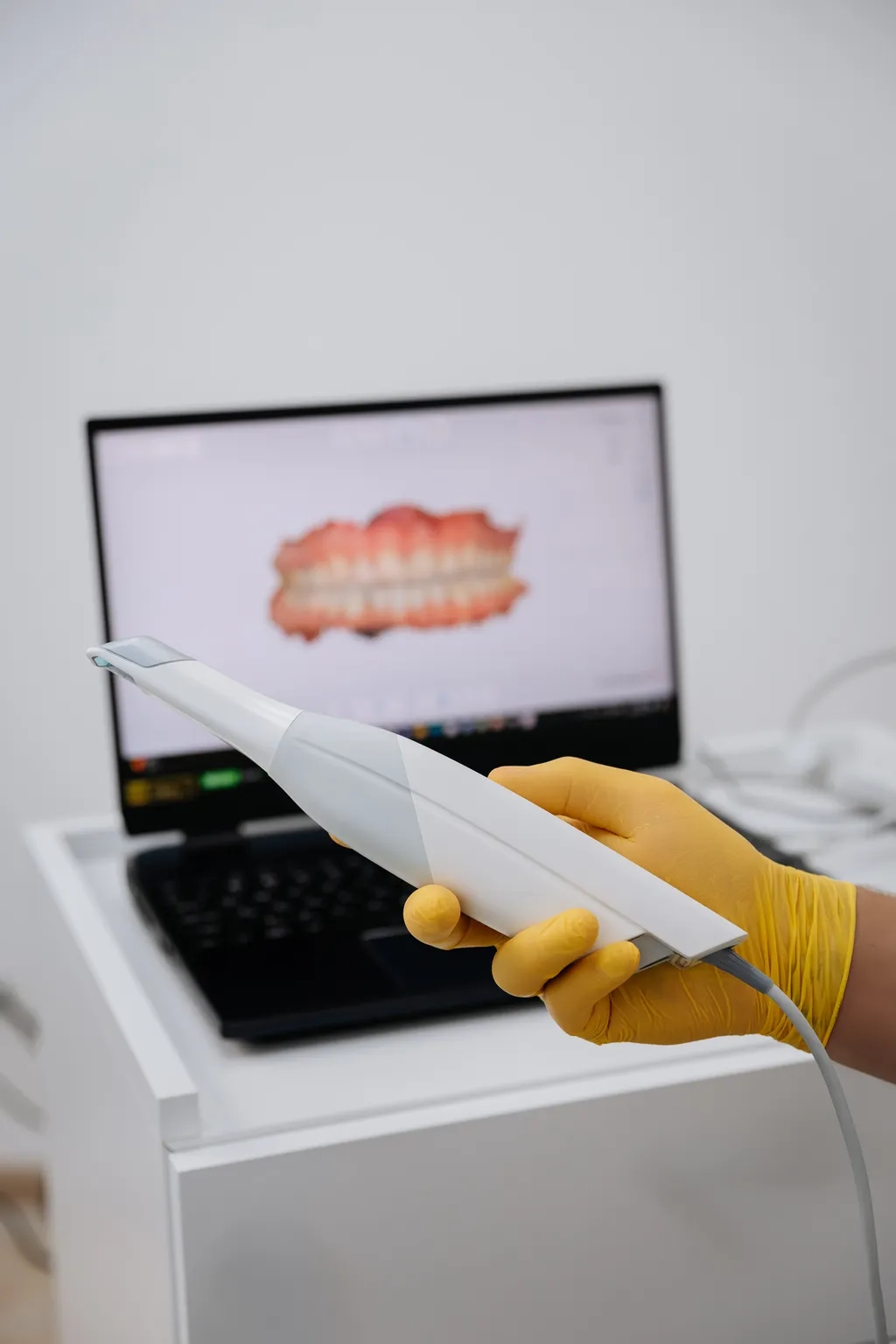 Háromdimenziós digitális fogmodell a szkennelés után