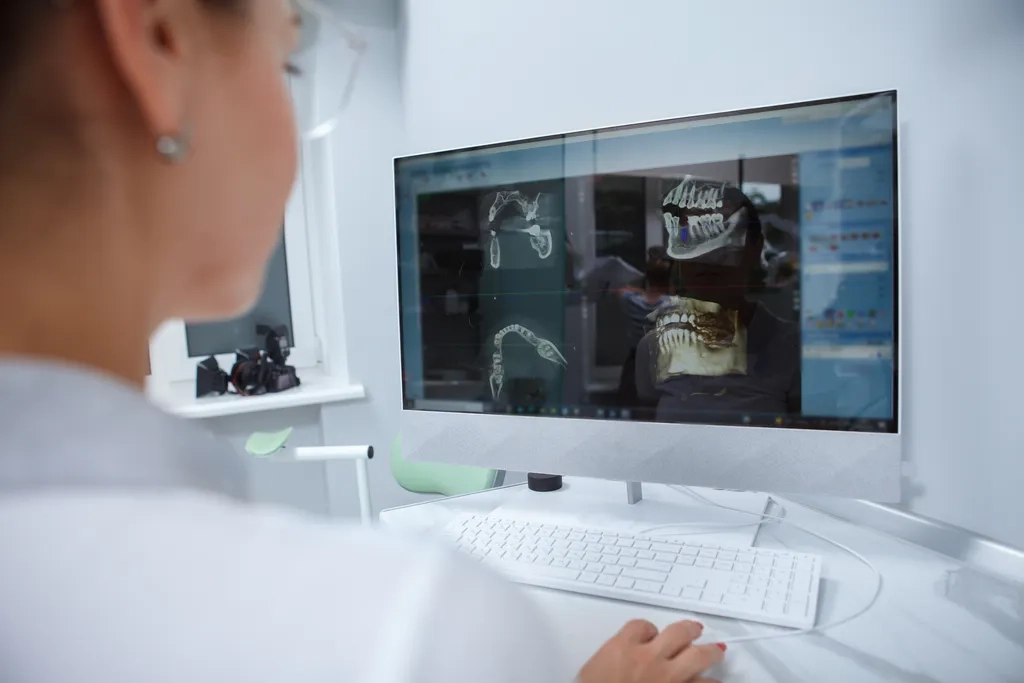 Fogorvos háromdimenziós felvételen tervezi az implantációt