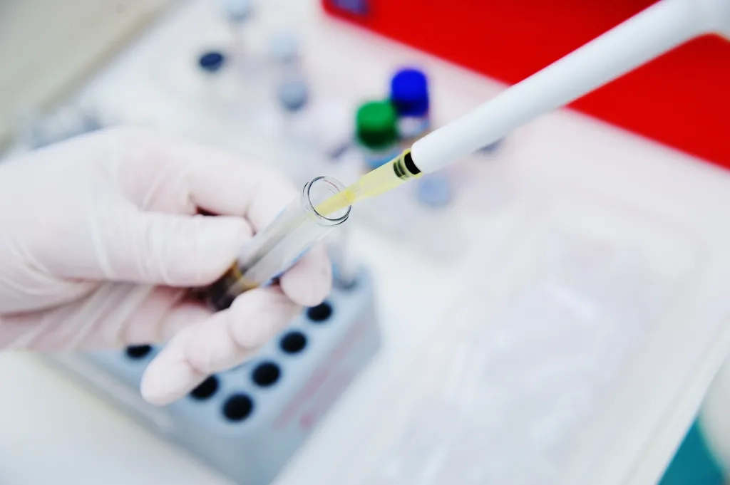 PRF membrán előkészítése steril laboratóriumi körülmények között